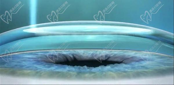 莆田华厦眼科医院