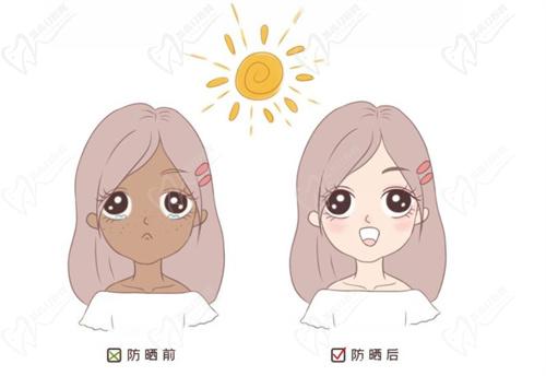 祛斑是激光好还是皮秒好
