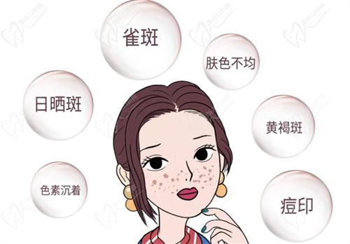 祛斑是激光好还是皮秒好
