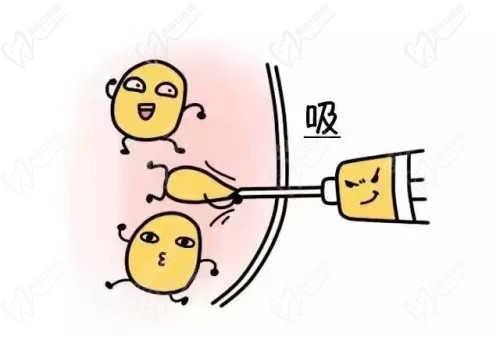 芜湖名姝医疗美容医院特色项目