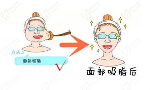 上海美莱侯怡医生擅长项目