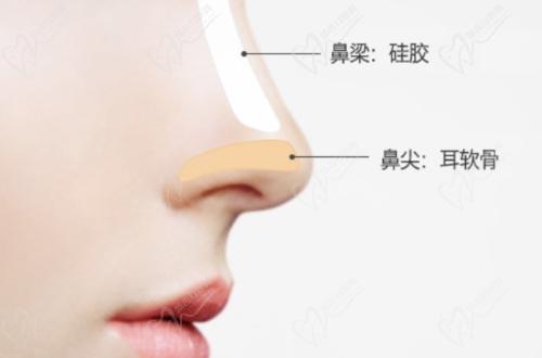 杨水斌做鼻子贵吗