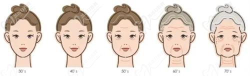 武汉美莱医疗美容医院超声炮做的好吗