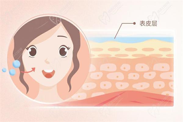 公主玻尿酸可以填充哪里