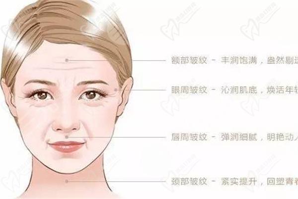 公主玻尿酸多少钱一支