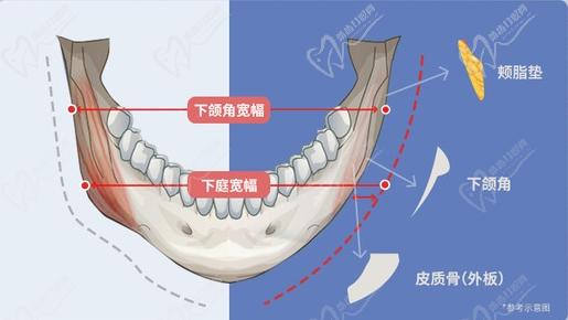 上海何晋龙的磨骨风格技术介绍