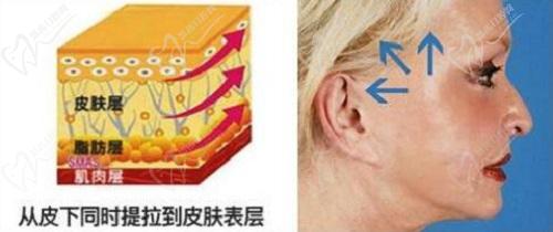 蒙石南拉皮和聂云飞拉皮区别