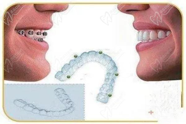 拉萨雅博仕口腔医院董海医生怎么样？看医生简介可见矫正经验多