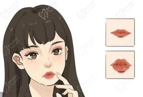 郑州缔莱美张继医生玻尿酸丰唇多少钱？