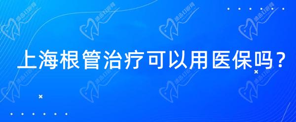 上海根管治疗可以用医 保吗
