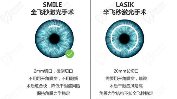 全飞秒手术