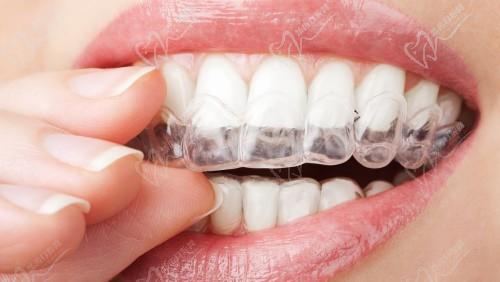 珠海六和口腔儿牙早期矫正的矫正器