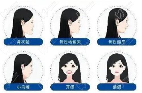 艾伟健医生怎么样