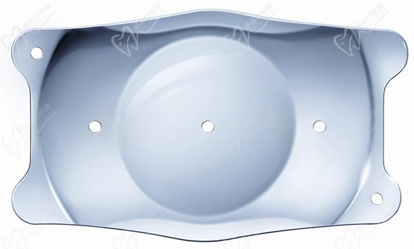 TICL晶体植入手术的利与弊