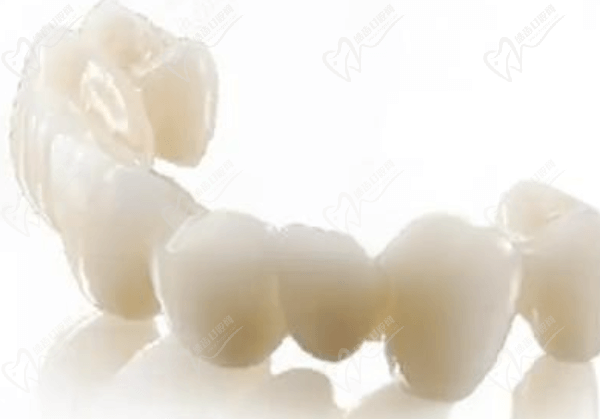 爱尔创全瓷牙是国产还是进口好？