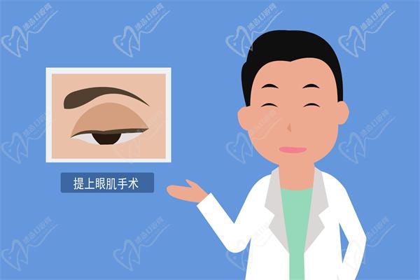 上脸下垂手术
