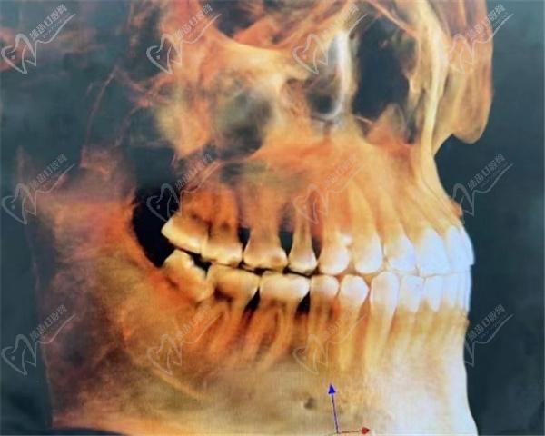 运城运中口腔医院种牙怎么样