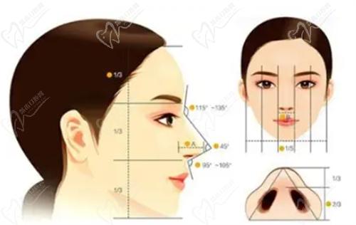 王志医生的鼻综合整形手术后鼻子自然吗？
