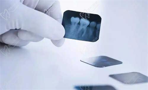 西安小白兔口腔医院儿童口腔