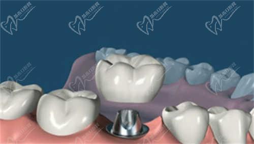 西安小白兔口腔医院价格表
