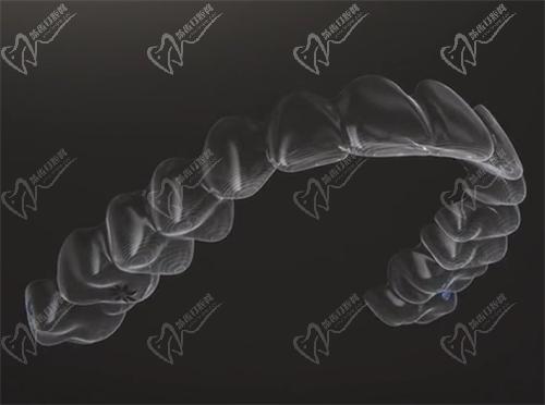 35岁还能矫正牙齿吗?