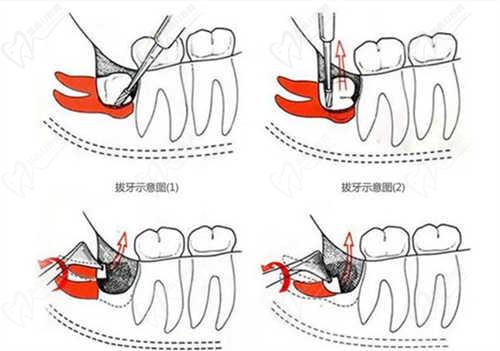 许昌小叮当口腔门诊部怎么样好不好