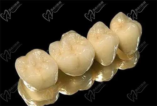 许昌小叮当口腔门诊部特色手术项目：种植牙