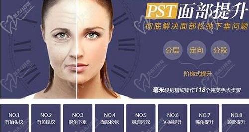 李晓东pst面部提升手术技术优势