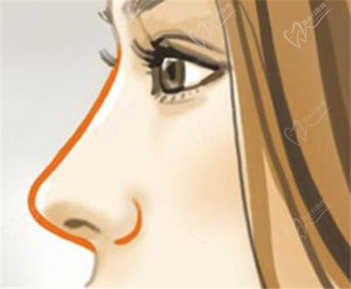 郑州美莱医疗美容医院姜南医生怎么样？