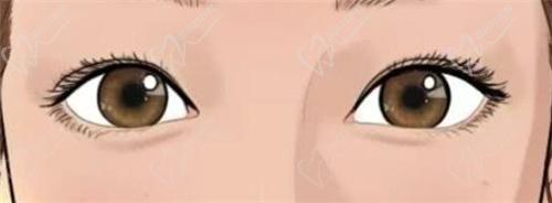 杭州薇琳医疗美容医院双眼皮价格是多少? 杭州薇琳医疗美容医院双眼皮价格是多少?