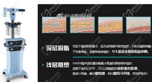 成都华生铂悦威塑吸脂是院内的一大特色