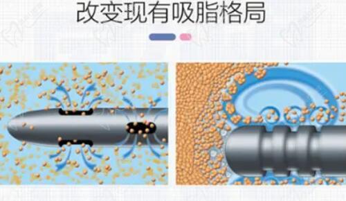 成都华生铂悦威塑吸脂技术优势