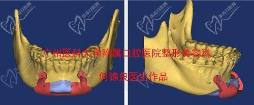 何锦泉个人资料简介