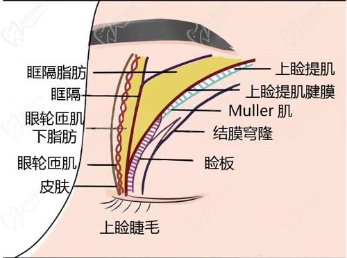 长沙美之峰解灿双眼皮修复技术