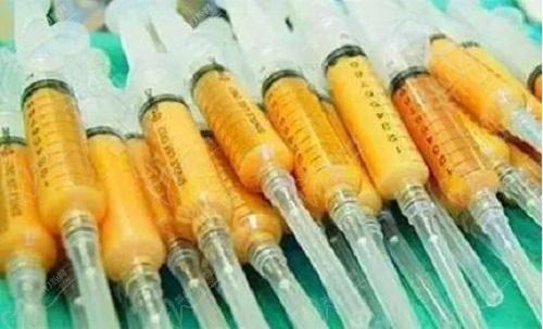 南京华美蔡跃波吸脂