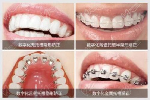 张家口麦格口腔张天畅擅长项目