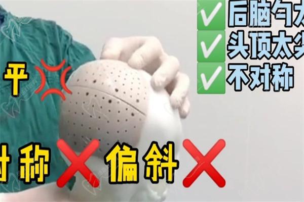 、何晋龙peek颅骨修复后不会松动