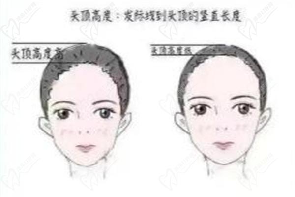 何晋龙后脑勺整形预约挂号