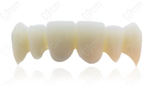 西安小白兔口腔牙贴面多少钱