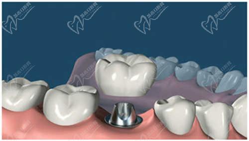 日照微笑口腔医院主要项目及价格