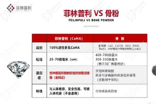 芭 比针和濡白天使哪个好
