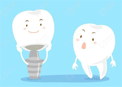 泉州盛安口腔种植牙价格表