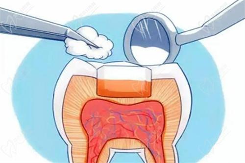 衡水可恩口腔医院补牙价格不贵