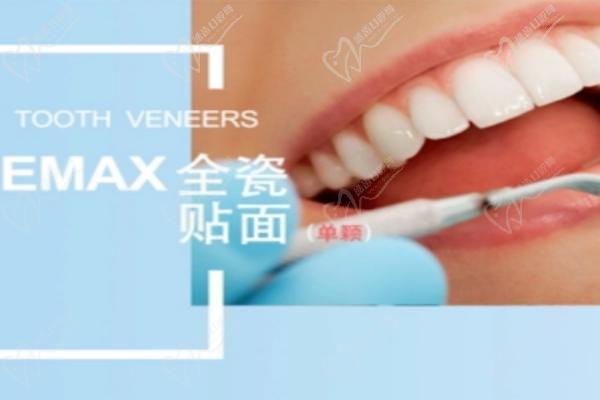 广大口腔医院半口瓷贴面美白好评