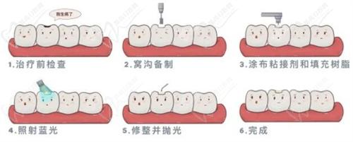 广州补牙哪家医院好？