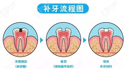 广州广大口腔补牙医生推荐