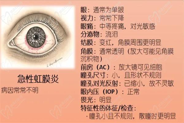 上海和平眼科医院虹膜外科怎么样