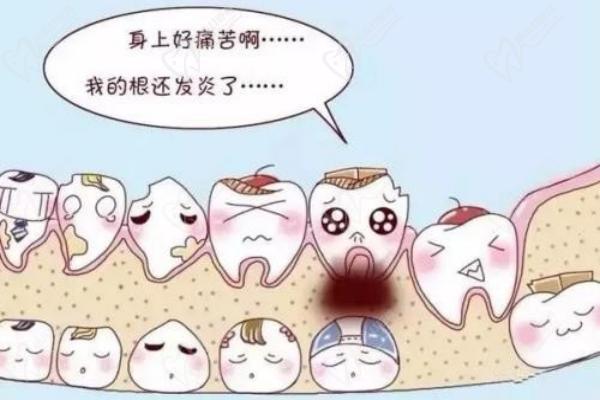 广州广大口腔医院补牙费用