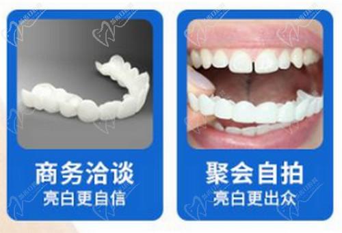 广州广大口腔全口戴立白美牙器美白牙齿备受称赞