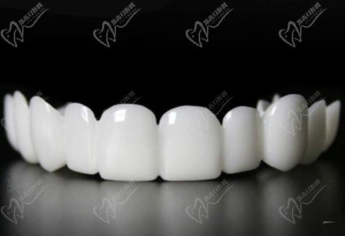 广州广大口腔全口戴立白美牙器美白牙齿口碑不错
